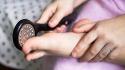 Narośl na palcu u nóg - przyczyny i leczenie