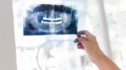 Zdjęcie pantomograficzne zębów - cena, wskazania i przeciwwskazania