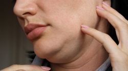 Nie tylko guzek. Lekarz wymienia objawy raka tarczycy, które najczęściej lekceważymy