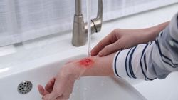 Rivanol - skład, działanie, wskazania, przeciwwskazania, dawkowanie, skutki uboczne