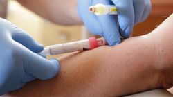 Krzywa insulinowa - wskazania, przeciwwskazania, przebieg, normy