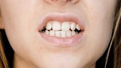 Przeskakiwanie żuchwy - przyczyny, objawy, diagnostyka, leczenie