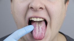 Chorobę zobaczysz na języku. Lekarka ostrzega