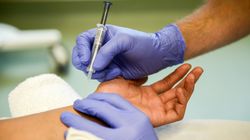 Gazometria - przygotowanie, interpretacja wyników, znaczenie diagnostyczne