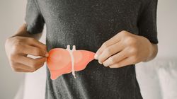 Kamica przewodowa - przyczyny, objawy i leczenie