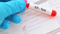 Badania mikrobiologiczne (posiew) - na czym polegają, rodzaje, wskazania