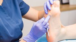 Pęcherze na stopach - leczenie i domowe sposoby, zapobieganie