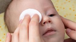 Udrożnienie kanału łzowego u niemowląt - na czym polega?