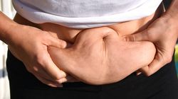 Usuwanie nadmiaru skóry - przebieg, wskazania, powikłania