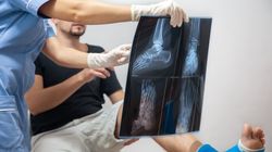 Trzeszczka - budowa, lokalizacja, funkcje i patologie