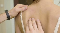 Skrzywienie kręgosłupa - rodzaje, przyczyny, objawy, leczenie, profilaktyka