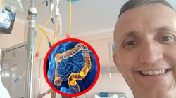 Pierwszy objaw nie przestraszył Pawła. Rak zajął już jelita, wątrobę