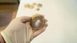 Gronkowiec skórny - jak można się zarazić i jakie choroby wywołuje?