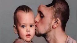 Przez popularne napoje stracił pół czaszki. Dramat młodego ojca z Kalifornii 