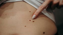 Kilka minut co trzy tygodnie. Prosta rutyna, która może wykryć chorobę