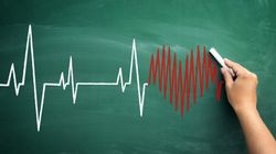 EKG - wskazania, przebieg badania, co wykrywa, zalety i wady