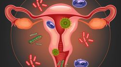 Czym charakteryzują się bakteryjne infekcje pochwy?
