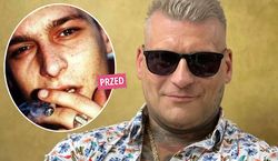Popek pociął sobie twarz, żeby się „upiększyć”. Jak teraz wygląda? Zdjęcia po metamorfozie