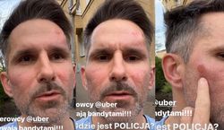 Marcin Bosak padł ofiarą napaści: „Dostałem solidne bęcki”. Jego syn również znalazł się w niebezpieczeństwie