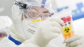 Już nie tylko Chiny, ale także europejskie gospodarki odczuwają konsekwencje epidemii Covid-19.