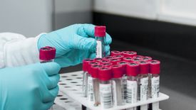 Polski lek na koronawirusa. Biomed wystartował z produkcją.