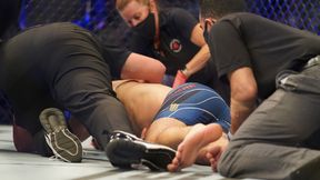 UFC 261. Weidman przeszedł operację po fatalnym złamaniu. Żona wydała oświadczenie