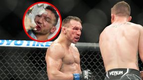 Wyciekło nagranie ze szpitala. Lekarze założyli zawodnikowi UFC 22 szwy po walce