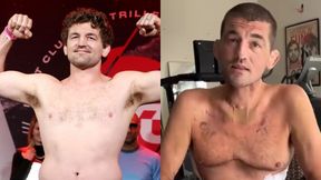 Trafił do szpitala z zapaleniem płuc. Tak teraz wygląda