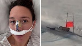 Koszmarny wypadek olimpijki. Wylądowała w szpitalu