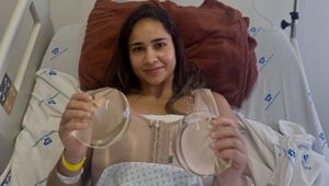 Usunęła implanty piersi. "Nie miałam pojęcia o ryzyku"