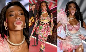 Modelka z bielactwem triumfuje na wybiegu Victoria's Secret