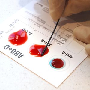 Sprawdź, jaki wpływ na Twoje życie ma grupa krwi. 10 fascynujących faktów!
