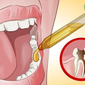 Poznaj domowy sposób na ból zęba. Pomoże Ci uśmierzyć ból do czasu wizyty u dentysty