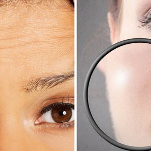 3 nieinwazyjne sposoby na pozbycie się pomarszczonej i nieestetycznej skóry z twarzy