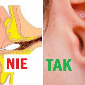 Kilka sprawdzonych sposobów, dzięki którym bezpiecznie usuniesz zalegającą w uszach woskowinę