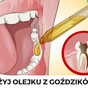 Naturalne sposoby na ból zęba. Pokonasz go w 10 minut!