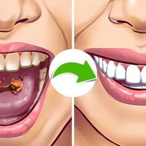 6 nietypowych sposobów na usunięcie kamienia na zębach i pozbycie się nieświeżego oddechu