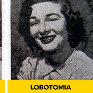 Mylące zdjęcia przed i po lobotomii. Ci pacjenci przeszli piekło