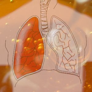 Pozbądź się śluzu z płuc i wzmocnij swój układ odpornościowy. Ten napój Ci w tym pomoże