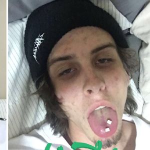 Podzielił się zdjęciami zrobionymi na 745 dni od rzucenia narkotyków. Przemiana zachwyca