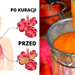 Wyjątkowo skuteczny syrop na kaszel domowej roboty. Przepis polecił mu znajomy lekarz