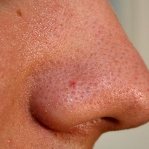 Badanie: Mężczyźni z większymi nosami mają większe przyrodzenia
