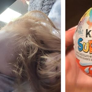 3-latka trafiła do szpitala po zjedzeniu „jajka niespodzianki”. Mama dziewczynki ostrzega innych