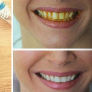 Wybiel zęby w bezpieczny sposób bez wydawania fortuny. Wystarczy tylko jeden naturalny składnik