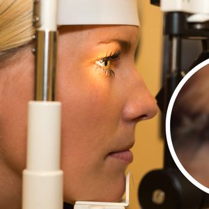 Lekarze byli przerażeni, kiedy odkryli co było przyczyną problemów z okiem pacjentki