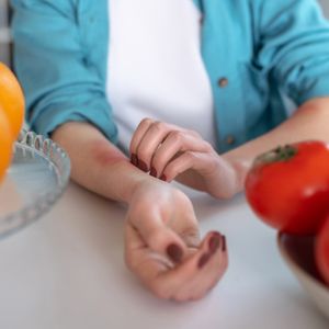 Alergia i nietolerancja na pomidory. Jak rozpoznać na jakie schorzenie cierpimy?