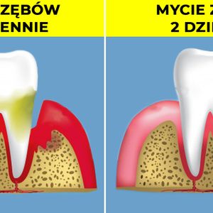 7 prostych sposobów, które poradzą sobie z ubytkami oraz leczeniem próchnicy zębów