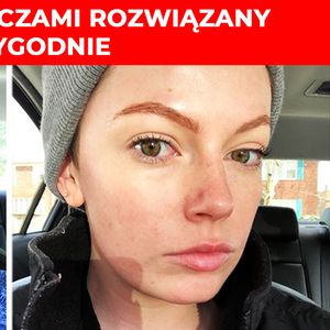 5 sprawdzonych sposobów na walkę z brzydką cerą. Przywrócą Twojej skórze blask