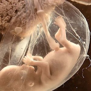 Ciąża pozamaciczna – zagrożenie, którego kobieta może nie być nawet świadoma