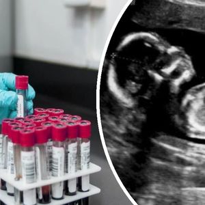 Test PAPP-A w ciąży. Czym jest i po co się go wykonuje?